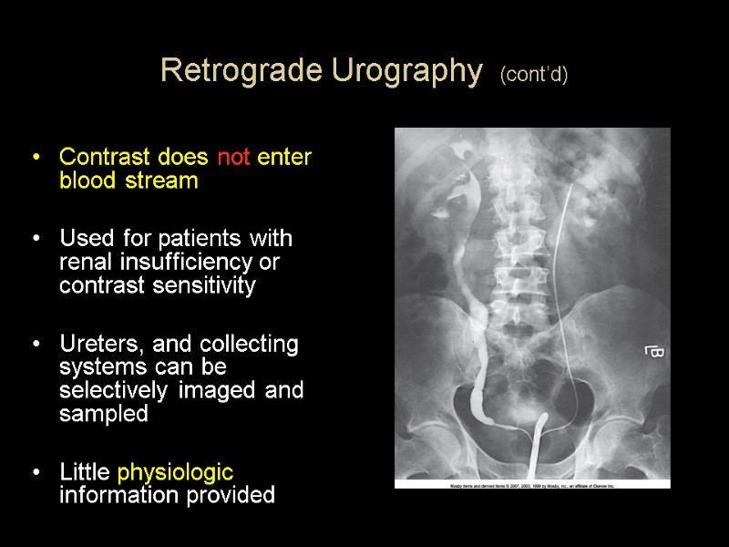 Retrograde Urography  (cont’d)   Contrast does not enter blood stream  Used